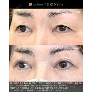 eクリニック 福岡院 伊藤 渉医師の症例