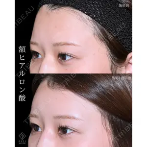 藤・ナチュレ美容クリニック 銀座院 小川 杏平医師の症例
