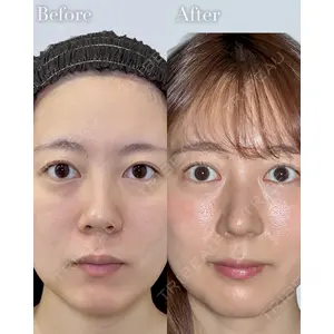 eクリニック 横浜みなとみらい院 坂本 優衣医師の症例