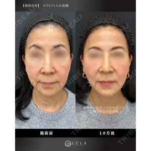 ルラ美容クリニック 名古屋栄院 / ルラスキンクリニック 名古屋栄院 関戸 優医師の症例