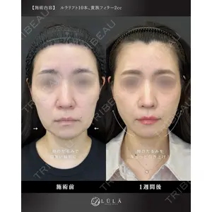 ルラ美容クリニック 名古屋栄院 / ルラスキンクリニック 名古屋栄院 関戸 優医師の症例