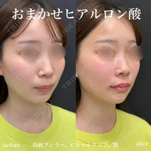 ルラ美容クリニック 名古屋栄院 / ルラスキンクリニック 名古屋栄院 関戸 優医師の症例