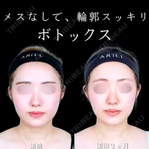 アリエル美容クリニック 大宮院の症例