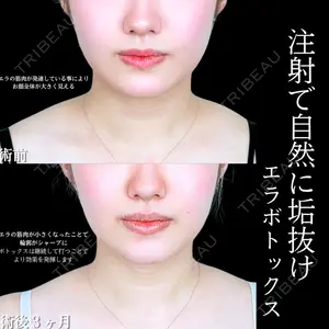 アリエル美容クリニック 大宮院の症例