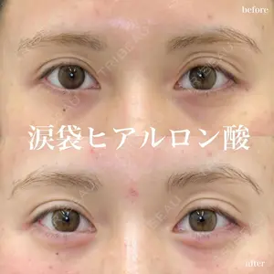 ルラ美容クリニック 名古屋栄院 / ルラスキンクリニック 名古屋栄院 関戸 優医師の症例