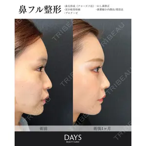 Days Beauty Clinic 新宿院の症例