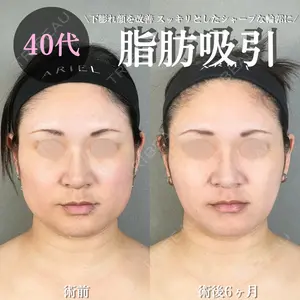 アリエル美容クリニック 大宮院 鈴木　桂介医師の症例