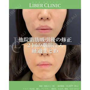 LIBER CLINIC 矢橋 洋一郎医師の症例