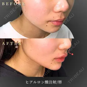 BiBiクリニックの症例