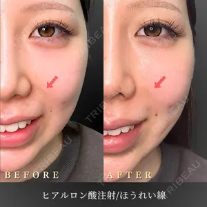 BiBiクリニック 山本 幸一郎医師の症例
