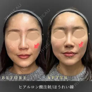 BiBiクリニック 山本 幸一郎医師の症例