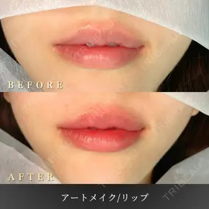 BiBiクリニック 山本 幸一郎医師の症例