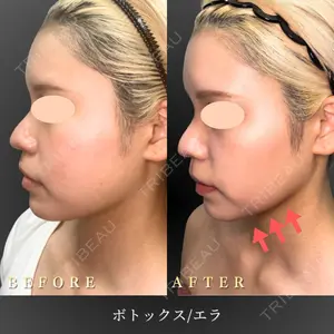 BiBiクリニック 山本 幸一郎医師の症例