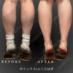 BiBiクリニック 山本 幸一郎医師の症例