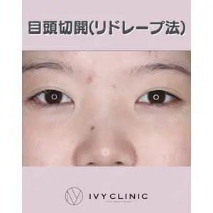 千葉美容外科アイビークリニック 藤田 愛樹医師の症例