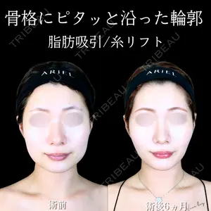 アリエル美容クリニック 大宮院 江郷隼一郎医師の症例