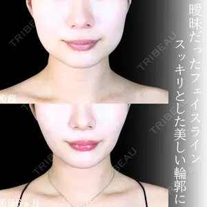 アリエル美容クリニック 大宮院 江郷隼一郎医師の症例