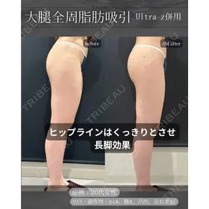 eクリニック 岡山院 勘定 正哉医師の症例