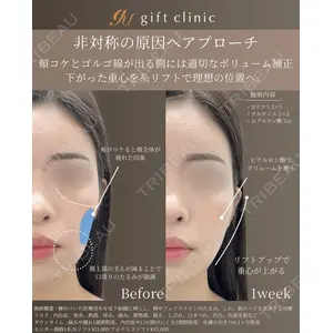 gift clinic 能登谷 翔医師の症例