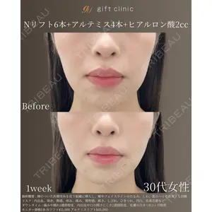 gift clinic 能登谷 翔医師の症例