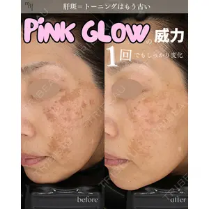 muni skin clinicの症例