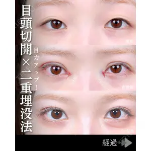 東京シンデレラ美容外科 池袋院 石井 達也医師の症例