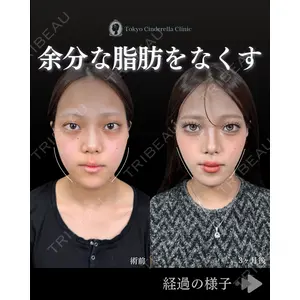 東京シンデレラ美容外科 池袋院 石井 達也医師の症例