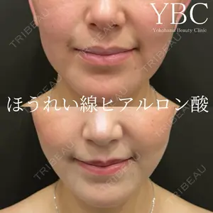 YBC横浜美容外科 池袋院の症例