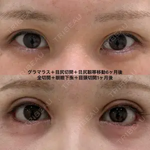 エターナル美容クリニック 久門田 詳医師の症例