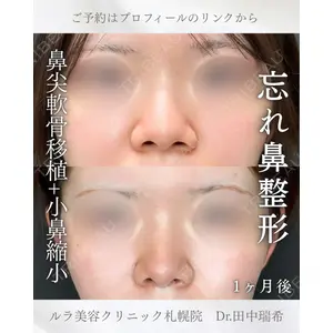 ルラ美容クリニック 札幌本院 田中 瑞希医師の症例