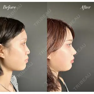 R Beauty CLINIC 名古屋院 木村 尚大医師の症例
