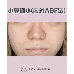 千葉美容外科アイビークリニック 藤田 愛樹医師の症例