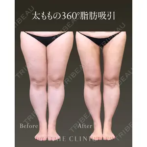 THE CLINIC（ザ・クリニック） 名古屋院 加藤 和樹医師の症例