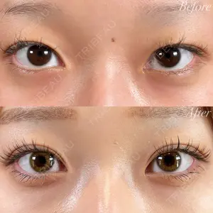 R Beauty CLINIC 銀座院 富田 莉沙子医師の症例