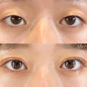 R Beauty CLINIC 銀座院 富田 莉沙子医師の症例