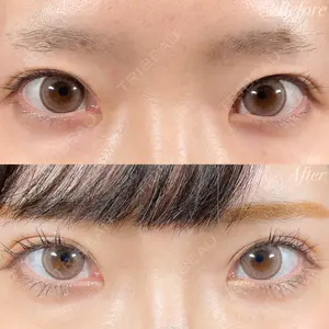 R Beauty CLINIC 銀座院 富田 莉沙子医師の症例