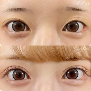 R Beauty CLINIC 銀座院 富田 莉沙子医師の症例