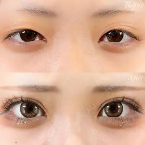 R Beauty CLINIC 銀座院 富田 莉沙子医師の症例