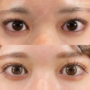 R Beauty CLINIC 銀座院 富田 莉沙子医師の症例