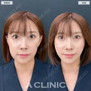 A CLINIC（エークリニック） 銀座院 長谷川 光医師の症例
