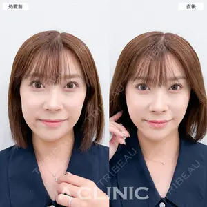 A CLINIC（エークリニック） 銀座院 長谷川 光医師の症例