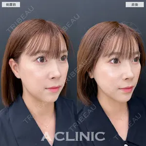 A CLINIC（エークリニック） 銀座院 長谷川 光医師の症例