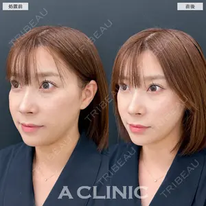 A CLINIC（エークリニック） 銀座院 長谷川 光医師の症例