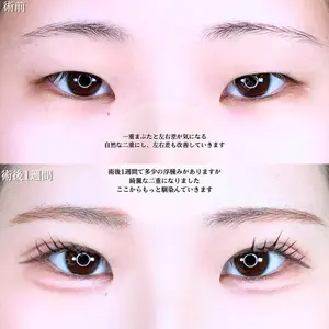 アリエル美容クリニック 水戸院 天白 典秀医師の症例