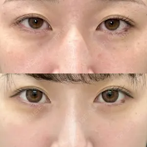 ルラ美容クリニック 札幌本院の症例