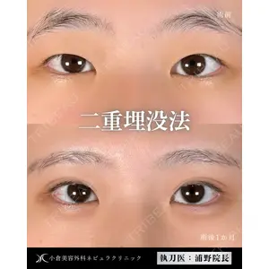 小倉美容外科ネビュラクリニック 浦野 正樹医師の症例