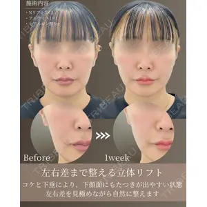 gift clinic 能登谷 翔医師の症例