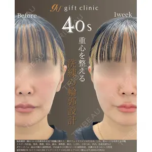 gift clinic 能登谷 翔医師の症例