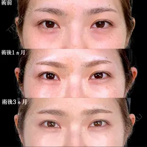 アリエル美容クリニック 水戸院 天白 典秀医師の症例