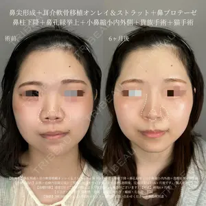 ASTRA BEAUTY CLINIC 塩満 惠子医師の症例